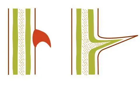 Разница между шипами и колючками