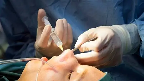 синдром пустого носа