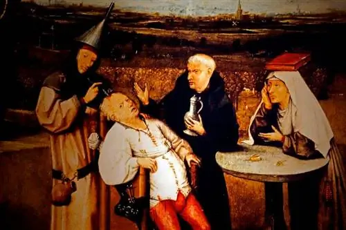 трепанация