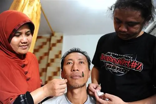 10 способов, которыми врачи лечили инфекции до появления антибиотиков