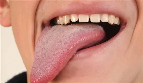 Можно ли проглотить язык?