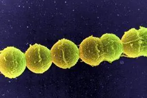 По оценкам, бактерии Streptococcus, изображенные здесь при большом увеличении, присутствуют почти на половине всех унитазов.
