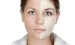 Галерея изображений типа кожи