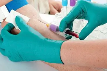 Гормональный дисбаланс и бесплодие