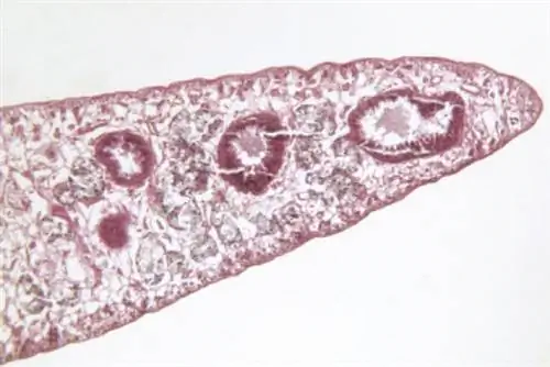 5 редких паразитов, обнаруженных в организме человека