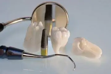 Безопасно ли использовать самодельные стоматологические инструменты?