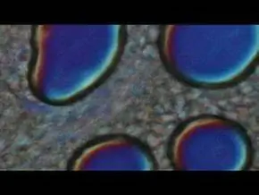 100 величайших открытий: истоки микробной теории