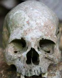 человеческий череп