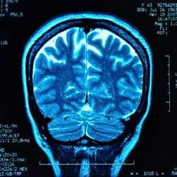 МРТ головного мозга синий