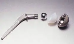 Титановый тазобедренный сустав