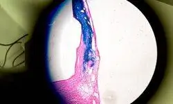 Микроскопическое изображение стволовых клеток сердца человека (синий цвет), восстанавливающих поврежденные клетки сердца крысы (розовый цвет) в исследовании Университета Джона Хопкинса.