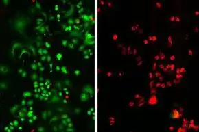 микрофотография рака