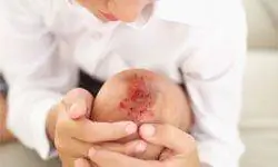 возвышенный вид мальчика, смотрящего на свое порезанное и ушибленное колено