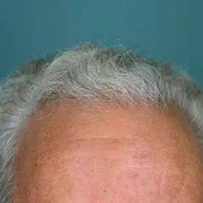 Линия волос человека.