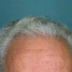 Отличается ли кожа головы от остальной кожи?