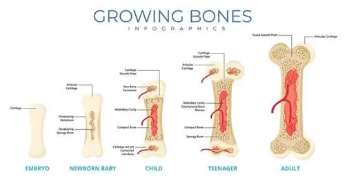 Растущие кости