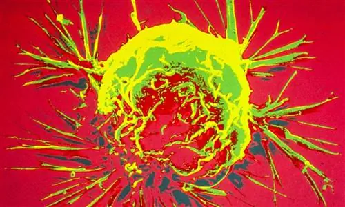 Как работают гены BRCA