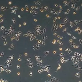 клетки рака шейки матки HeLa