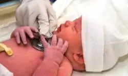 Распространенные врожденные дефекты