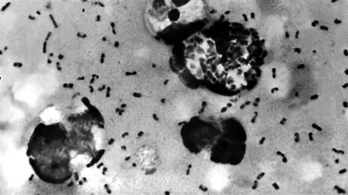 мазок от бубонной чумы