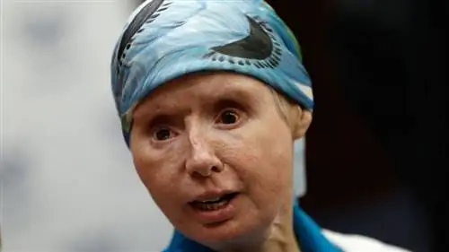 Чарла Нэш, пресс-конференция, растерзание шимпанзе