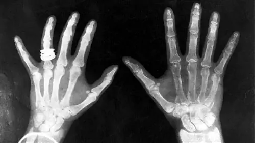 Как работает рентген