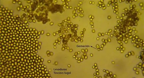 дрожжи под микроскопом