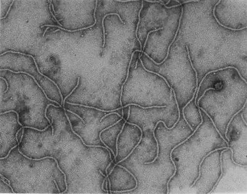 клостеровирус