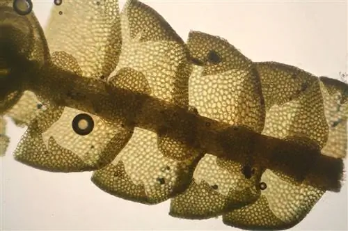 Стенка растительной клетки состоит из первичной стенки, вторичной стенки и срединной пластинки.