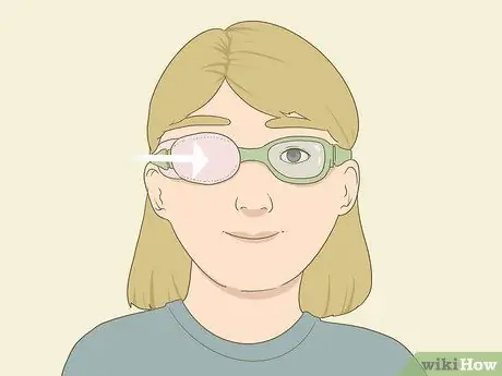 Носите повязку на глаз Step 6 Носите повязку на глаз Step 6