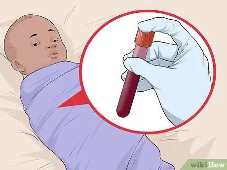 Убить Toxoplasma Gondii Шаг 7