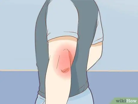 Сломай локоть, шаг 1