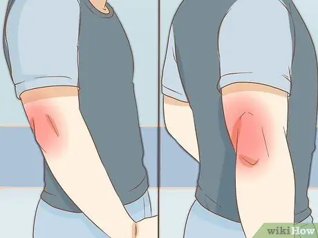 Сломай локоть, шаг 2