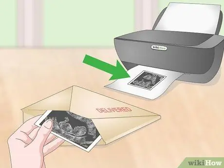 Сохранение фотографий УЗИ Шаг 10