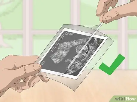 Сохранение фотографий УЗИ Шаг 4