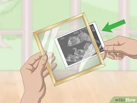 Сохранение фотографий УЗИ Шаг 5