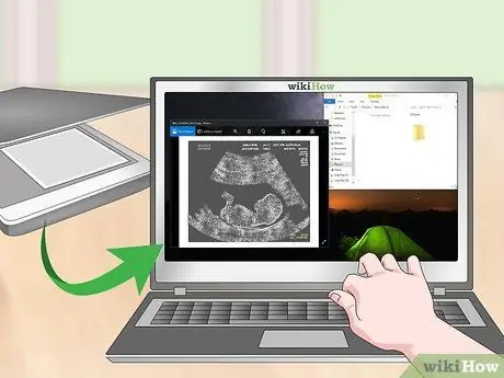 Сохранение фотографий УЗИ Шаг 8