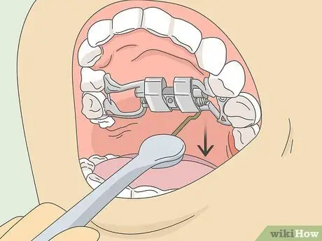 Поверните Expander Step 5