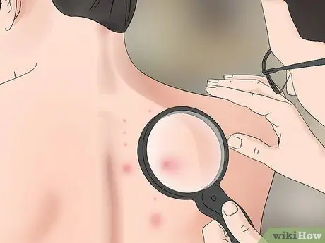 Убить шершневое гнездо, шаг 1