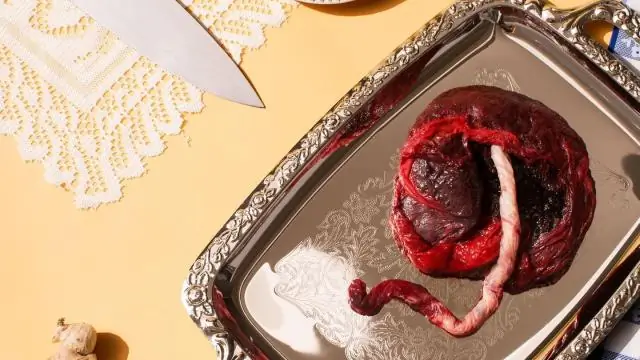 Что будет, если съесть гипс?