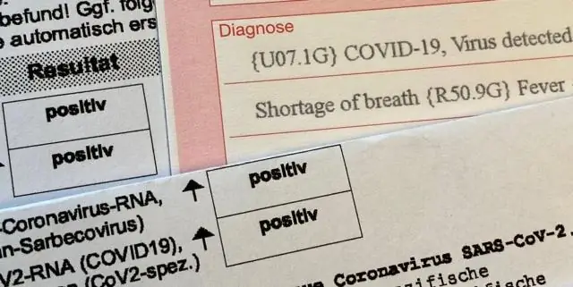 Как узнать, есть ли у меня резервный клапан канализации?
