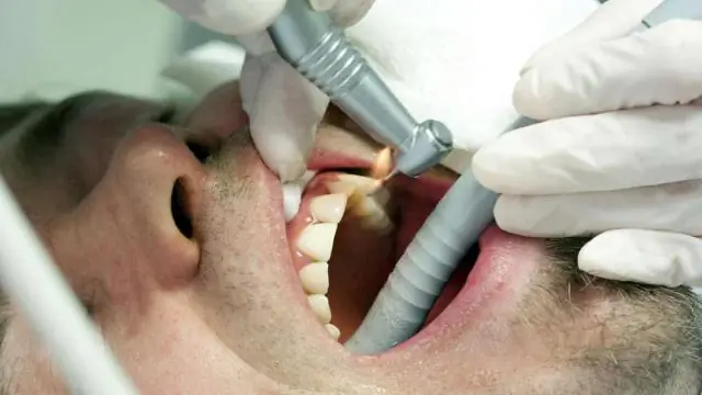 Можно ли отремонтировать окна Thermopane?