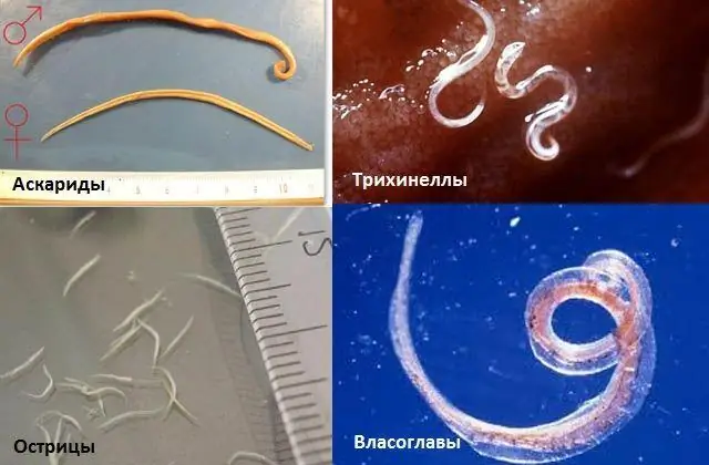 В чем разница между морозильной камерой и морозильной камерой?