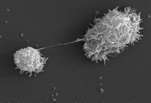 К какому типу возбудителя относится Legionella pneumophila?