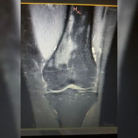 Как выглядит пион?