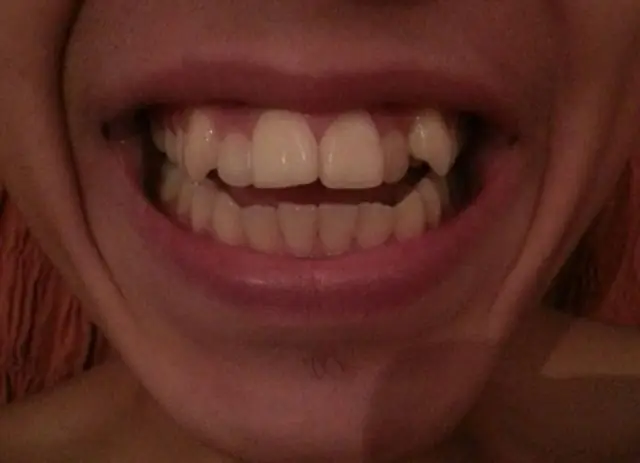 Сколько стоит автоответчик?