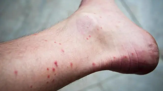 Что вызывает солому на лужайке?